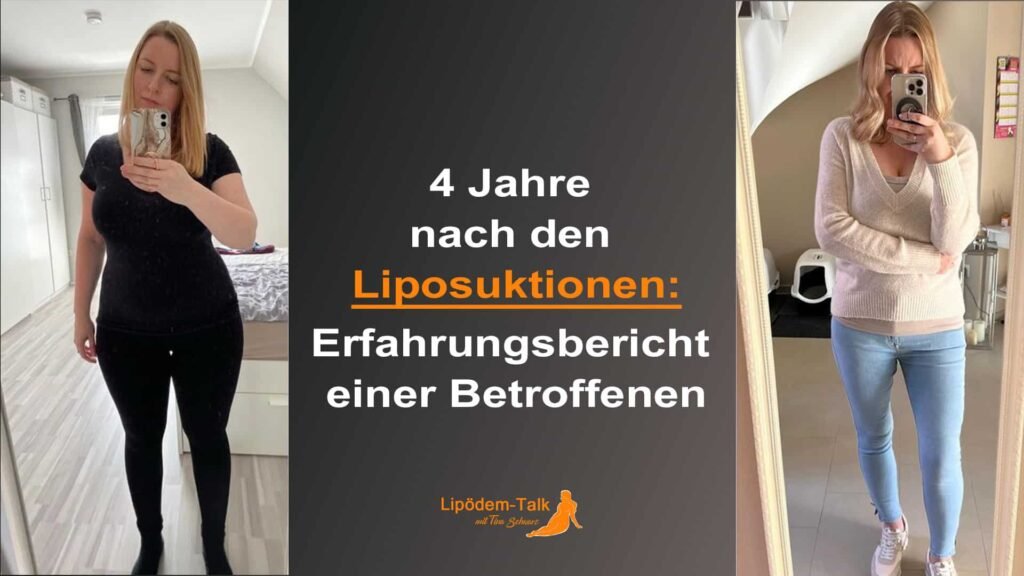 Fettabsaugung